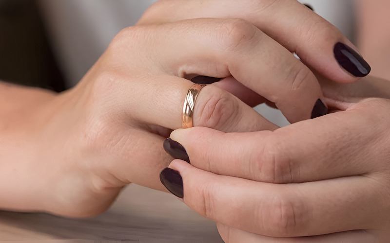 Ngón tay bị sưng tấy và tím lại do đeo nhẫn cưới quá chật.
