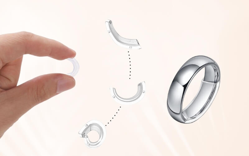 Miếng lót nhẫn là phương pháp ít tốn kém được ưa chuộng nhất