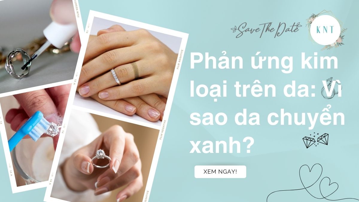 Phản ứng kim loại trên da: Vì sao da chuyển xanh?