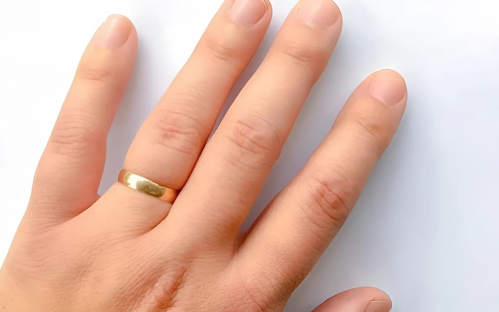 Đeo nhẫn quá chật không chỉ gây khó chịu mà còn có thể dẫn đến những hậu quả nghiêm trọng