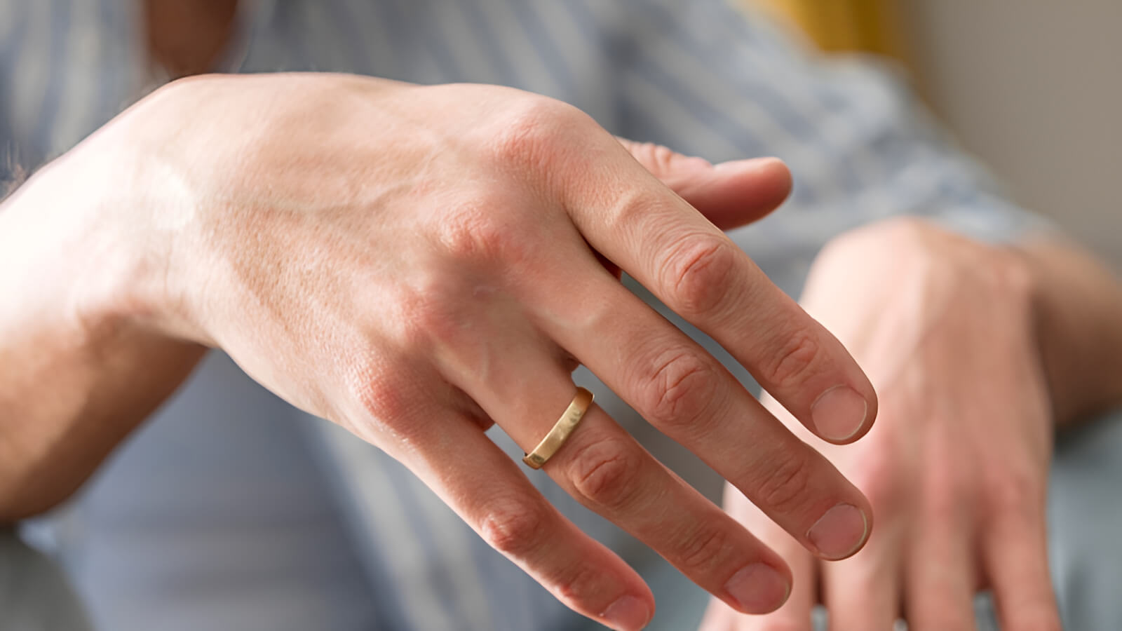 Va chạm thường ngày là nguyên nhân chính khiến nhẫn cưới bị biến dạng