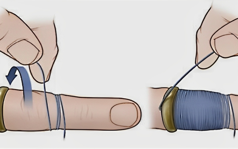 Sử dụng chỉ nha khoa hoặc sợi chỉ mảnh